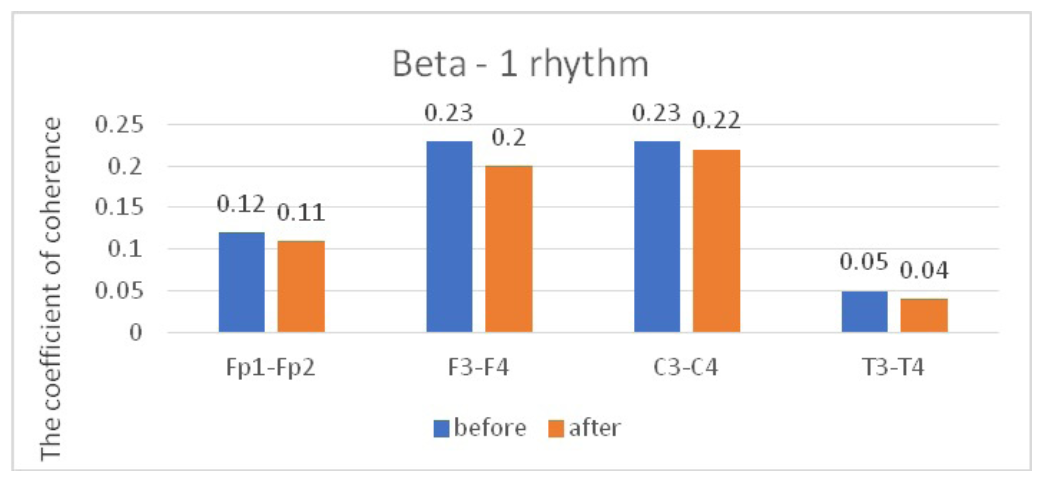 Fig. 2. Main characteristics of IC in healthy volunteers in the beta-1 band: blue column – before WT; orange column – after WT.